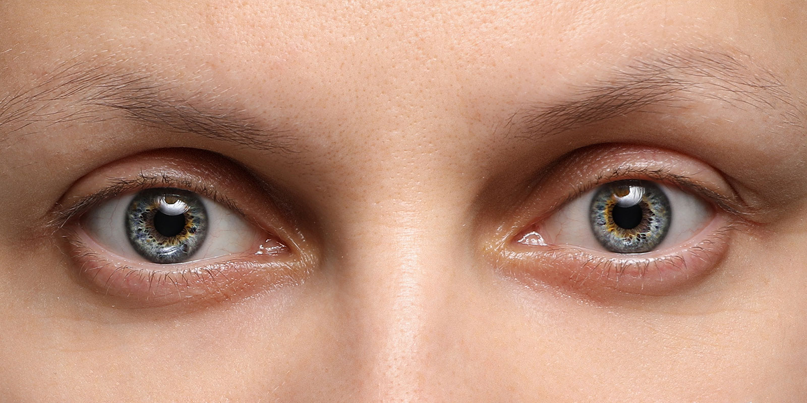 Miosis is the medical term for small or pinpoint pupils